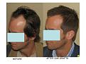 Click image for larger version

Name:	Slide8.JPG
Views:	779
Size:	64.2 KB
ID:	446269