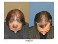 Click image for larger version

Name:	topdown.jpg
Views:	666
Size:	78.7 KB
ID:	446351