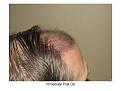 Click image for larger version

Name:	Slide5.JPG
Views:	579
Size:	68.6 KB
ID:	446353