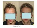 Click image for larger version

Name:	Slide7.JPG
Views:	1128
Size:	59.7 KB
ID:	446381