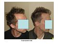 Click image for larger version

Name:	Slide8.JPG
Views:	752
Size:	57.6 KB
ID:	446382