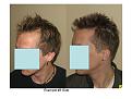 Click image for larger version

Name:	Slide9.JPG
Views:	753
Size:	58.1 KB
ID:	446383