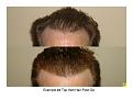 Click image for larger version

Name:	Slide11.JPG
Views:	796
Size:	50.0 KB
ID:	446385