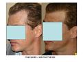 Click image for larger version

Name:	Slide12.JPG
Views:	783
Size:	65.1 KB
ID:	446386