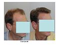 Click image for larger version

Name:	Slide15.JPG
Views:	715
Size:	49.6 KB
ID:	446389