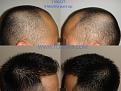Click image for larger version

Name:	1100 followup.jpg
Views:	738
Size:	61.5 KB
ID:	446467