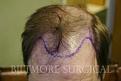 Click image for larger version

Name:	A pre-op JS w.jpg
Views:	556
Size:	16.4 KB
ID:	446484