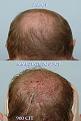 Click image for larger version

Name:	crown A.jpg
Views:	507
Size:	52.4 KB
ID:	446499