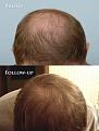 Click image for larger version

Name:	crown B.jpg
Views:	559
Size:	43.3 KB
ID:	446500