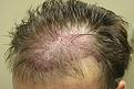 Click image for larger version

Name:	C JT immed postop.jpg
Views:	575
Size:	94.5 KB
ID:	446520