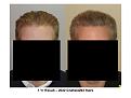 Click image for larger version

Name:	Slide4.JPG
Views:	401
Size:	45.8 KB
ID:	446546