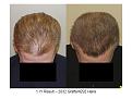 Click image for larger version

Name:	Slide5.JPG
Views:	451
Size:	65.5 KB
ID:	446547