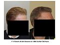 Click image for larger version

Name:	Slide14.JPG
Views:	373
Size:	49.9 KB
ID:	446556