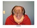 Click image for larger version

Name:	Slide8.JPG
Views:	746
Size:	57.7 KB
ID:	446588