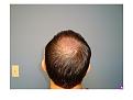Click image for larger version

Name:	Slide12.JPG
Views:	705
Size:	43.1 KB
ID:	446590