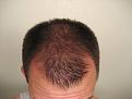 Click image for larger version

Name:	april09hair 015.jpg
Views:	661
Size:	91.2 KB
ID:	446597
