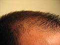 Click image for larger version

Name:	april09hair 013.jpg
Views:	592
Size:	89.5 KB
ID:	446598