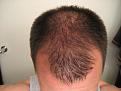 Click image for larger version

Name:	april09hair 004.jpg
Views:	600
Size:	89.3 KB
ID:	446599