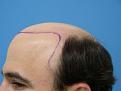 Click image for larger version

Name:	Hasson and Wong Shaved Side.jpg
Views:	1364
Size:	34.8 KB
ID:	446632