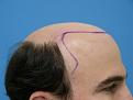 Click image for larger version

Name:	Hasson and Wong Shaved left side.jpg
Views:	1445
Size:	35.3 KB
ID:	446633