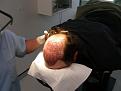 Click image for larger version

Name:	Hasson and Wong Imediately Post Surgery.jpg
Views:	1543
Size:	34.0 KB
ID:	446635