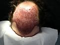 Click image for larger version

Name:	Hasson and Wong Immediately Post Surgery 2.jpg
Views:	1615
Size:	46.9 KB
ID:	446636