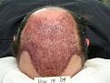 Click image for larger version

Name:	Hasson and Wong Immediately Post Surgery 3.jpg
Views:	2495
Size:	53.2 KB
ID:	446637
