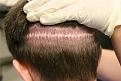 Click image for larger version

Name:	Scar - by Dr. Jones.jpg
Views:	3107
Size:	36.0 KB
ID:	446678