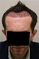 Click image for larger version

Name:	Post-op 1.jpg
Views:	2242
Size:	16.6 KB
ID:	446680