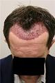 Click image for larger version

Name:	Post-op 2.jpg
Views:	2726
Size:	18.6 KB
ID:	446681