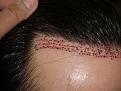brianp-bef-1-day-after0.jpg