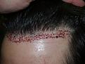 brianp-bef-1-day-after1.jpg