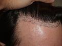 brianp-bef-1-day-after2.jpg