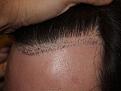 brianp-bef-1-day-after3.jpg
