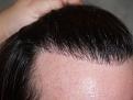 brianp-bef-1-day-after4.jpg