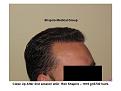 Click image for larger version

Name:	Slide7.JPG
Views:	491
Size:	58.9 KB
ID:	446752