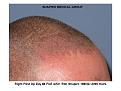 Click image for larger version

Name:	Slide6.JPG
Views:	503
Size:	82.2 KB
ID:	446792