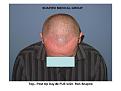 Click image for larger version

Name:	Slide8.JPG
Views:	506
Size:	57.5 KB
ID:	446794