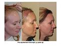 Click image for larger version

Name:	Slide7.JPG
Views:	8125
Size:	63.7 KB
ID:	446804