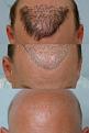 Click image for larger version

Name:	big repair pic.jpg
Views:	2326
Size:	40.3 KB
ID:	446806