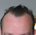 Click image for larger version

Name:	before.jpg
Views:	1670
Size:	18.5 KB
ID:	446847
