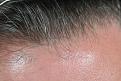 Click image for larger version

Name:	closeupfrontal.jpg
Views:	478
Size:	52.0 KB
ID:	446857
