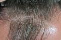 Click image for larger version

Name:	closeupmidfrontal.jpg
Views:	512
Size:	63.1 KB
ID:	446858