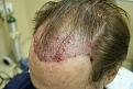 Click image for larger version

Name:	KB immedpreop2.jpg
Views:	570
Size:	89.8 KB
ID:	446863