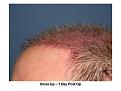 Click image for larger version

Name:	Slide2.JPG
Views:	1202
Size:	67.2 KB
ID:	447024
