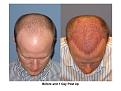 Click image for larger version

Name:	Slide4.JPG
Views:	1217
Size:	73.7 KB
ID:	447026