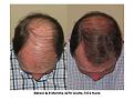 Click image for larger version

Name:	Slide3.JPG
Views:	727
Size:	83.8 KB
ID:	447038