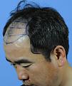 Click image for larger version

Name:	Preleftshavelines.jpg
Views:	422
Size:	71.7 KB
ID:	447241