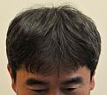 Click image for larger version

Name:	1yearfrontal.jpg
Views:	444
Size:	88.7 KB
ID:	447250