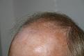 Click image for larger version

Name:	(after0805113706718) after0805113731531.jpg
Views:	503
Size:	89.1 KB
ID:	447292